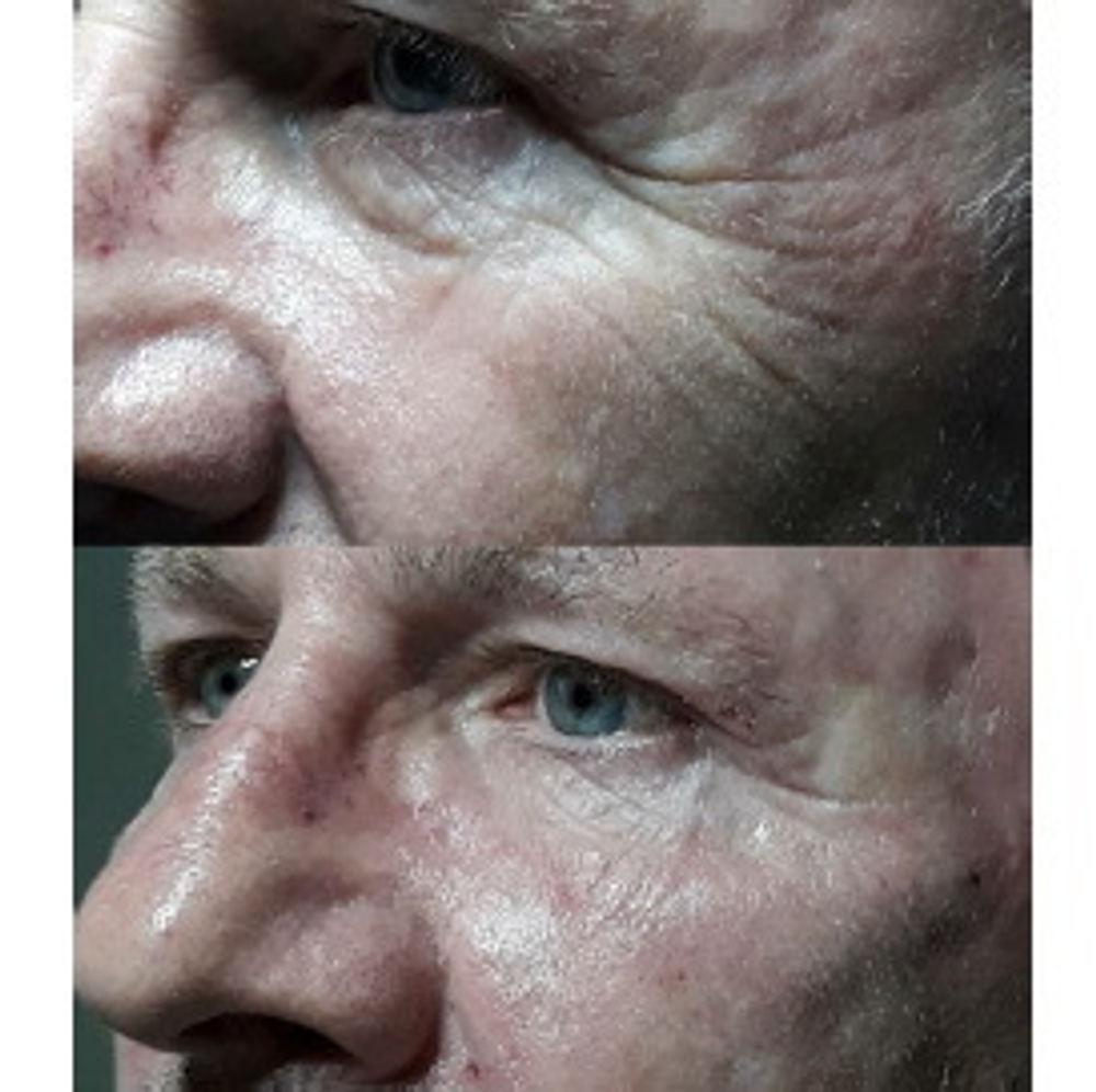 PDRN Rejuvenating Ampoule Eldermafill | Мощная регенерация