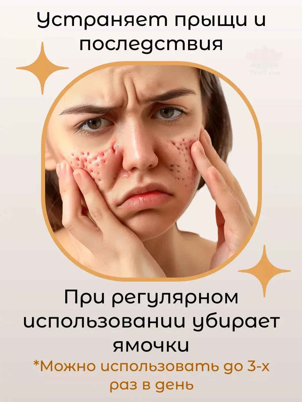 Отбеливающий крем для лица от пигмента с SPF защитой