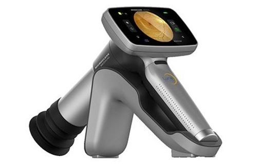 Портативная фундус-камера MicroCLear-HFC