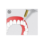 EDENTA STT249.314.016 Хирургический тканевый триммер для операции на мягких тканях полости рта STT249 FG, d 1,6 мм