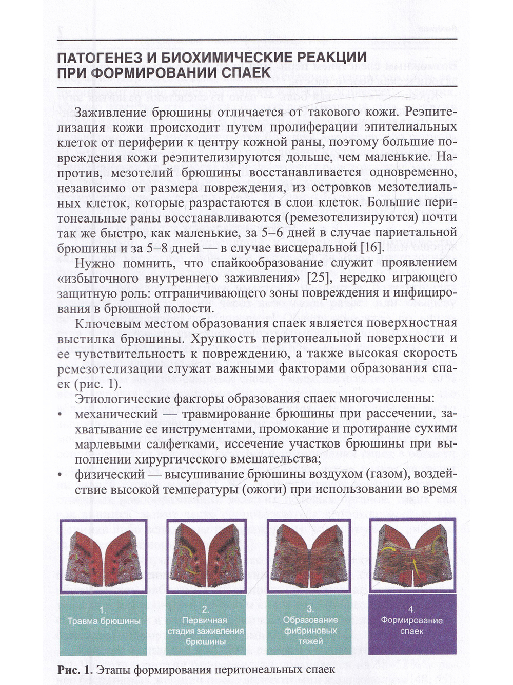Профилактика спайкообразования при операциях на органах малого таза: Пособие для врачей