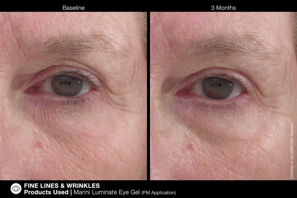 Концентрированная сыворотка для кожи вокруг глаз Jan Marini MARINI LUMINATE® EYE GEL, 15 мл