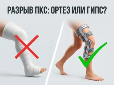 Разрыв передней крестообразной связки (ПКС): диагностика МРТ, тесты стабильности и подбор шарнирного ортеза