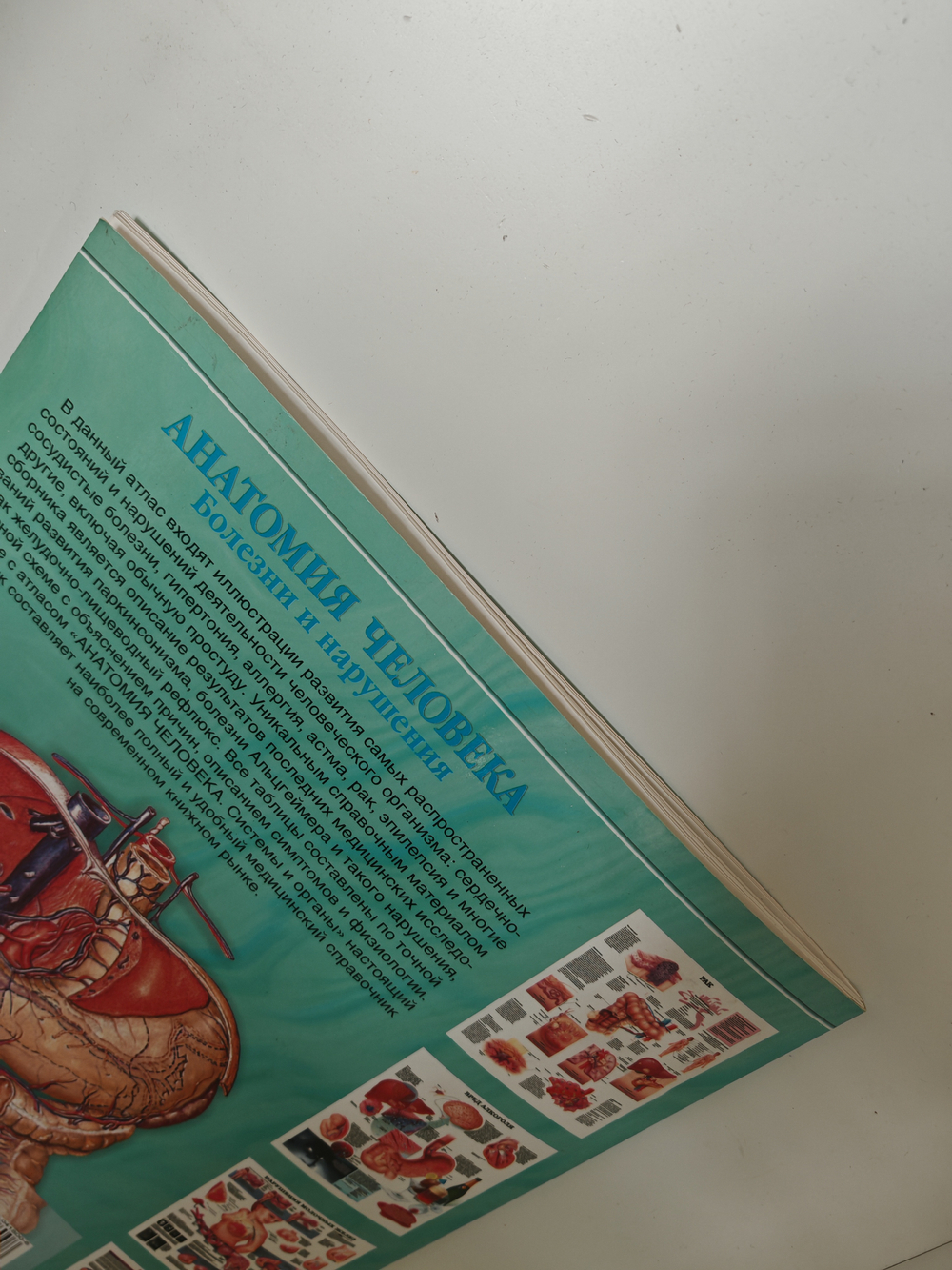 Анатомия человека: болезни и нарушения