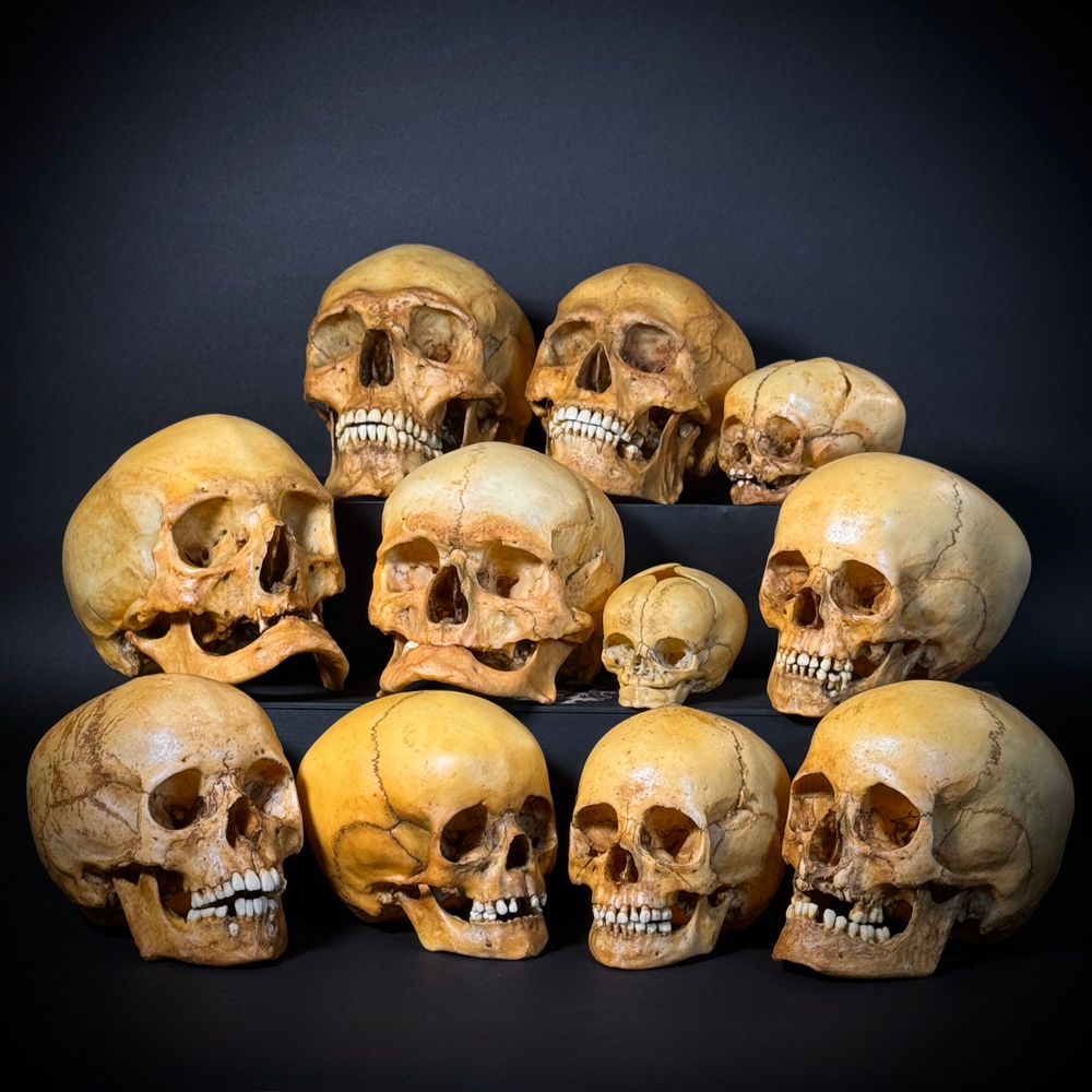 Набор «Череп человека» (анатомические модели)