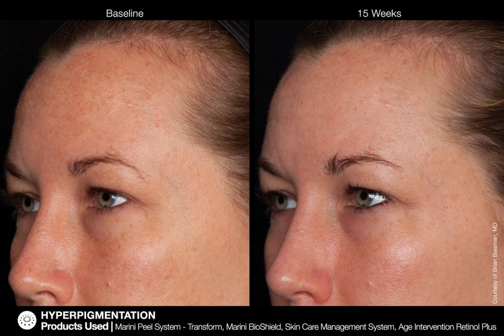 JAN MARINI AGE INTERVENTION RETINOL+ 0,5% Крем-акселератор с ретинолом 0,5% для борьбы с видимыми возрастными изменениями