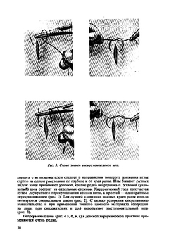 Оперативная хирургия с топографической анатомией детского возраста | Ю.Ф. Исаков; Ю.М. Лопухин