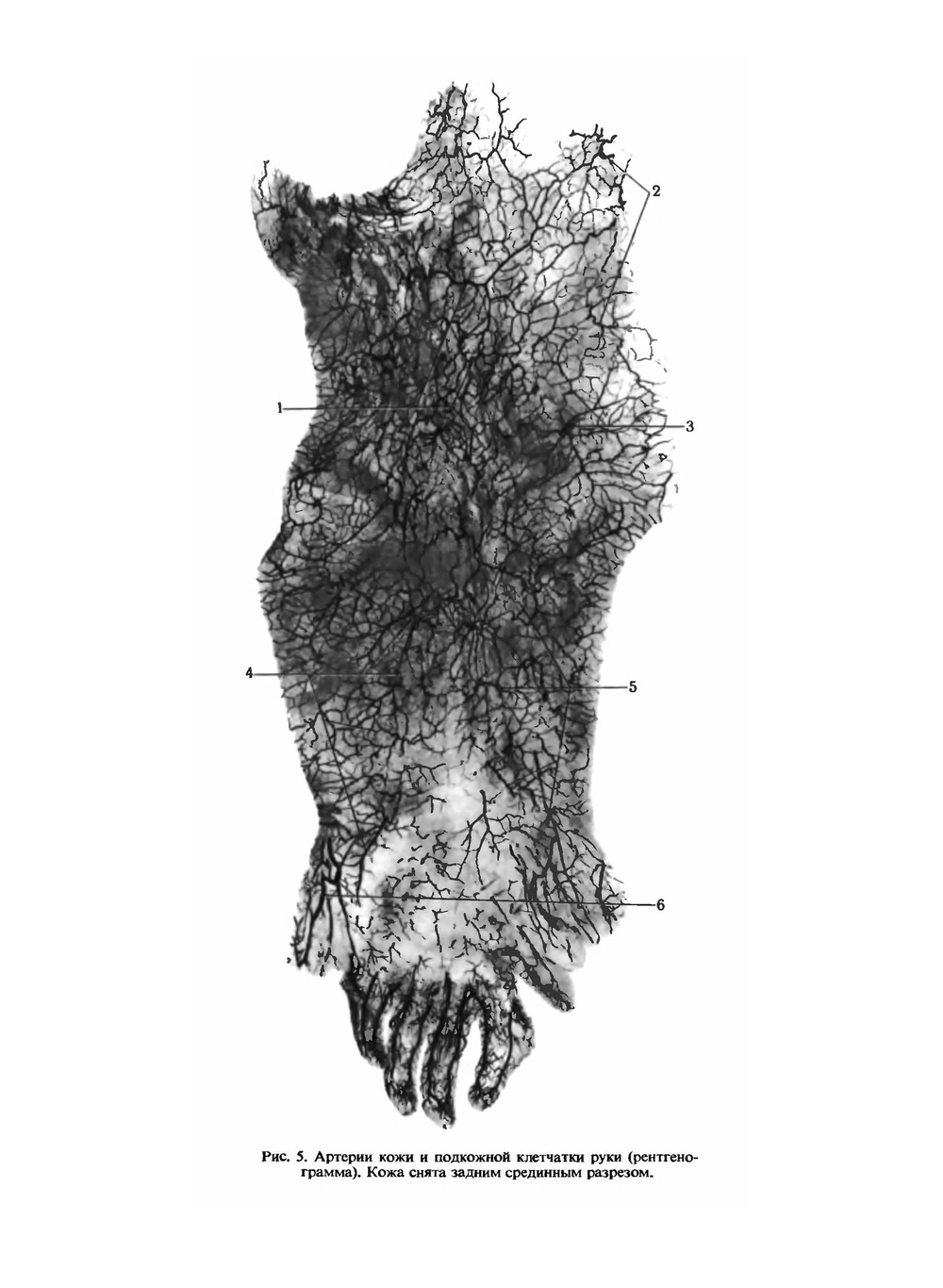 Атлас топографической анатомии человека. Том 3. Верхняя и нижняя конечности | Ю.Л. Золотко