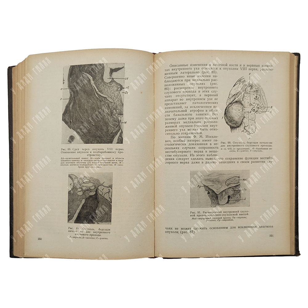 Циммерман Г. С. Клиническая отоневрология, 1952.