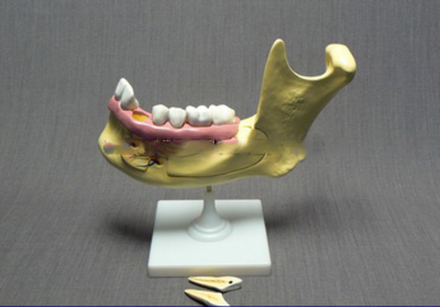 Модель Строение челюсти человека