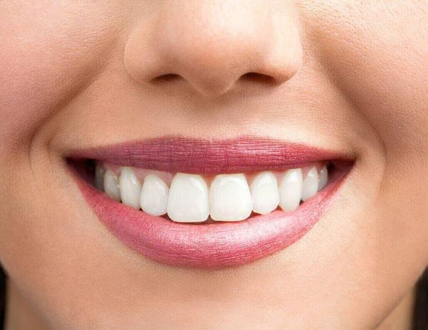 Как быть, чтобы «жемчуг» во рту сохранить? Часть 1.