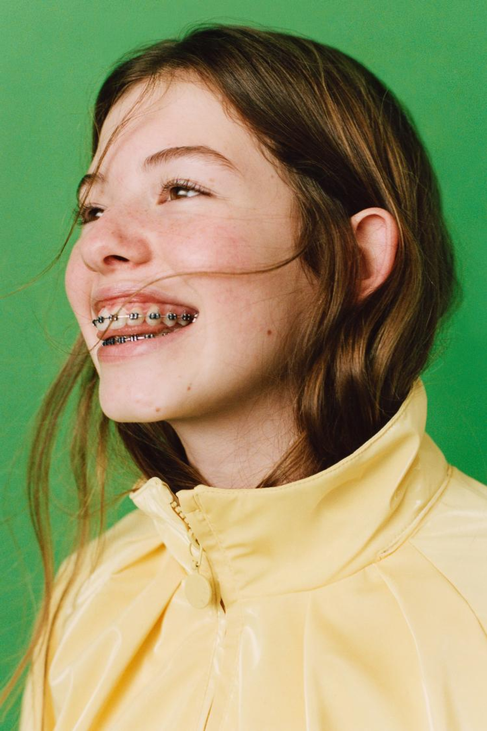 ZARA БЛЕСТЯЩИЙ ДОЖДЕВИК WATER RESISTANT, ЖЕЛТЫЙ