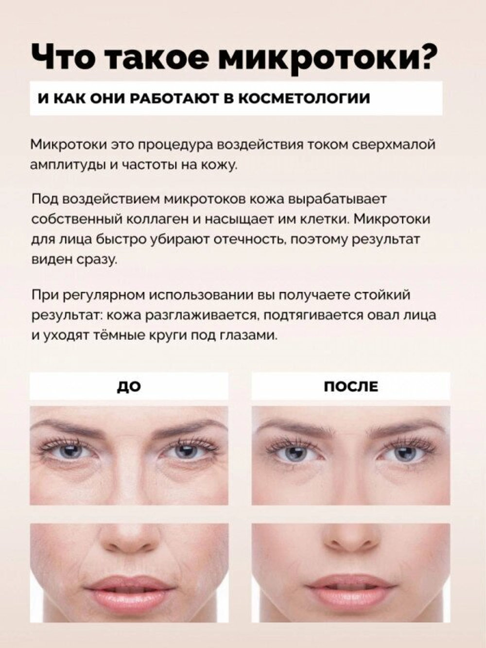 MT аппарат для микротоковой терапии, микротоки для лица GESS-135
