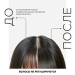 L'Oreal Professionnel Scalp Advanced успокаивающий гель-уход для чувствительной кожи головы, 200 мл.