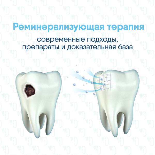 Реминерализующая терапия: современные подходы, препараты и доказательная база Реминерализующая терапия: современные подходы, препараты и доказательная база