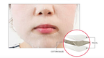 Merbliss nurse healing gauze seal mask – Sos тканевая маска для лица