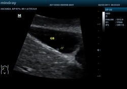 Аппарат УЗИ (сканер) Mindray DP-50