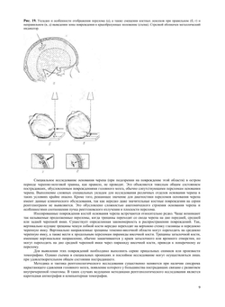 Неотложная рентгено-диагностика. Руководство | А.Н. Кишковский