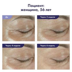 Obagi Medical Ночной крем для век Elastiderm Eye Treatment Cream, 15 гр