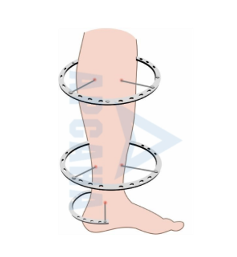 Чехлы на гипс / лангет, стопу 