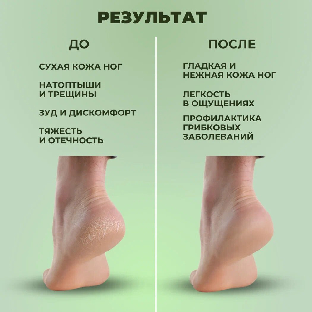 Средство для пяток