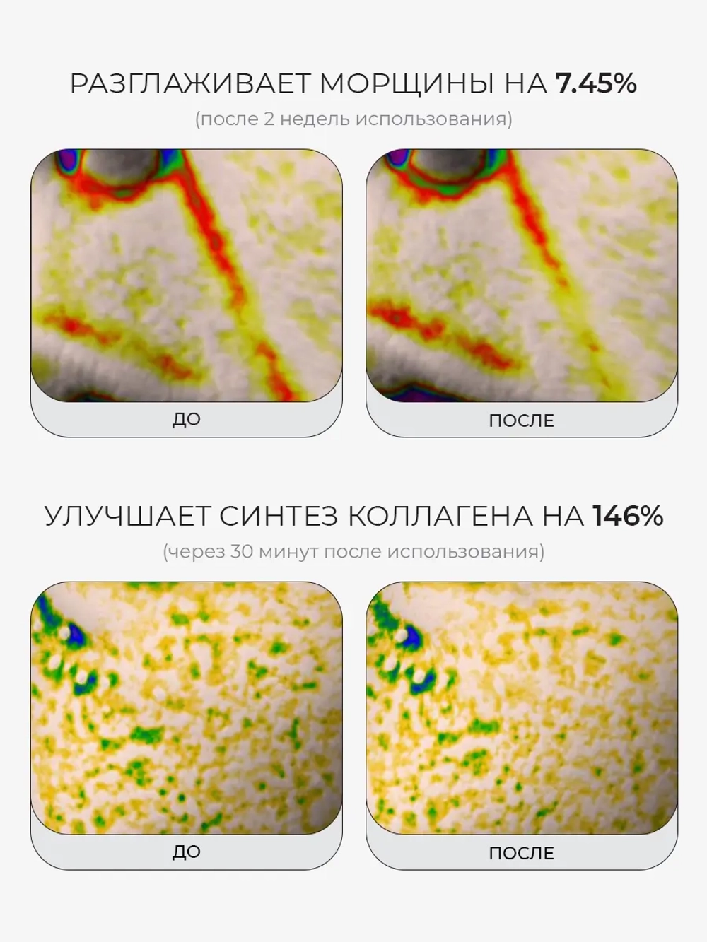 Medicube Сыворотка с микроиглами, ПДРН и экзосомами против морщин и пигментации PDRN Pink Collagen Exosome Shot 7500 30 мл