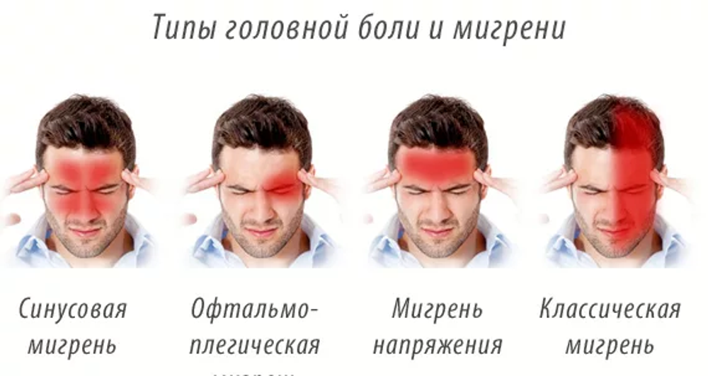Мигрень, излечение головной боли