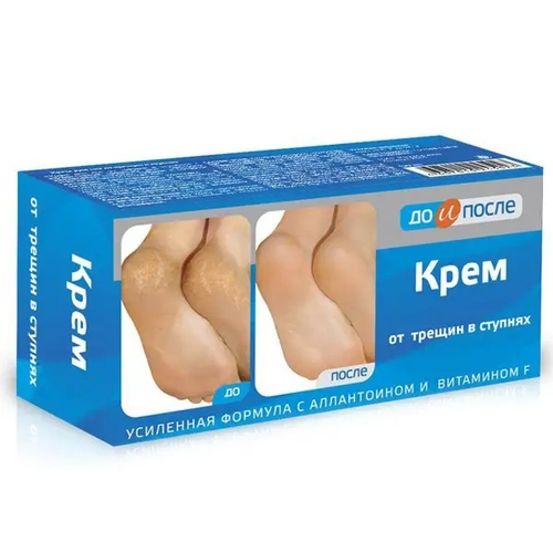 До и После Крем от трещин в ступнях 150 мл