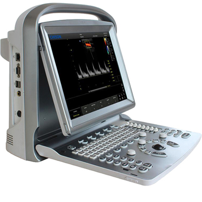 УЗИ аппарат Chison SonoTouch 50