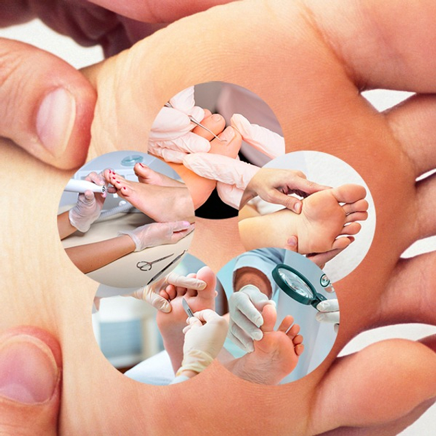 Подологические услуги любой сложности