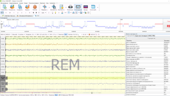 АМБУЛАТОРНАЯ ПСГ С ВИДЕОРЕГИСТРАЦИЕЙ (ТИП II)