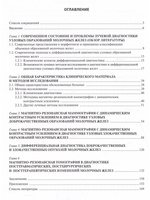 МРТ в маммологии: руководство для врачей