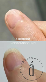 LED-аппарат для светотерапии ногтей