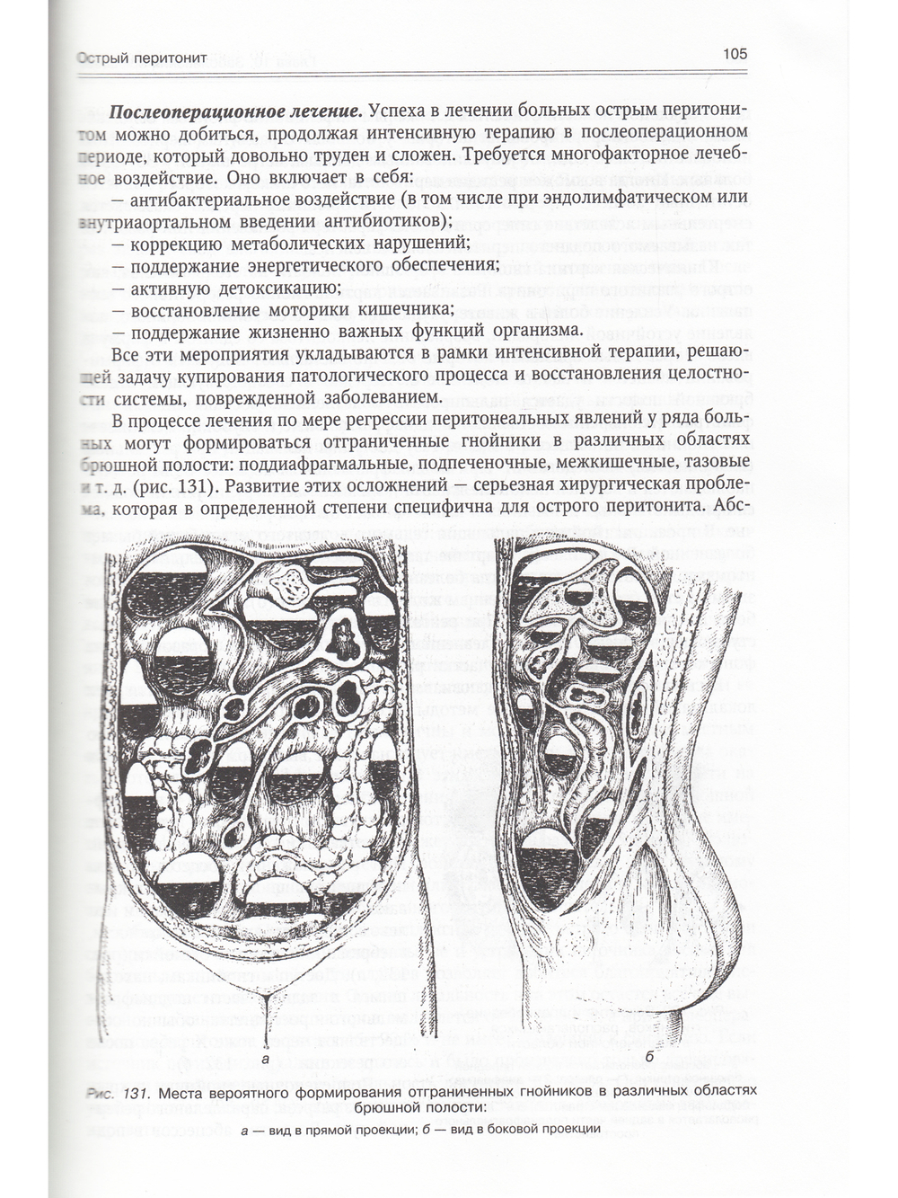 Госпитальная хирургия т.2 2-е издание