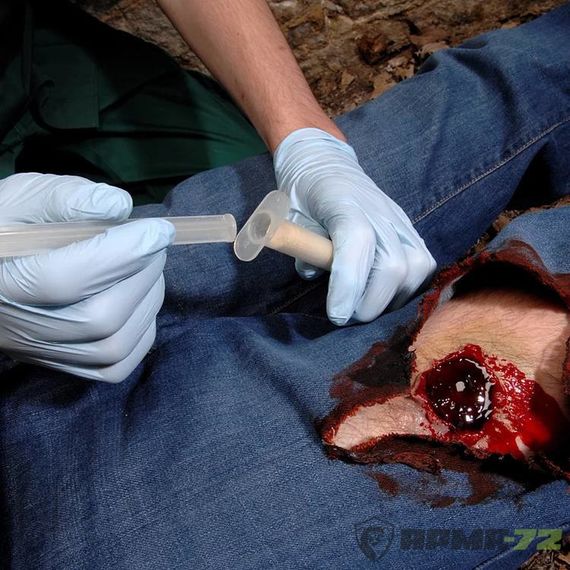 Аппликатор хитозановый гемостатический с гранулами «PRO»