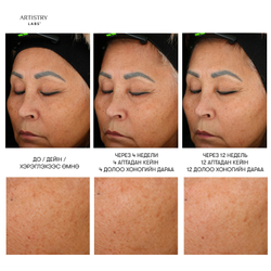 Artistry Labs Illuminating System™ Комплекс для осветления кожи лица