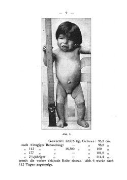 Die Rolle der Schilddrüse bei Stillstand und Hemmung des Wachstums und der Entwicklung | E. Hertoghe