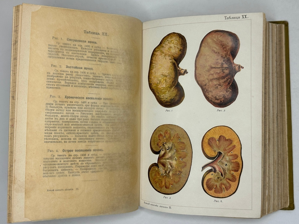 Платен М. Новый способ лечения. Лечение целебными силами природы. — Берлин: Изд. Просвещение, 1901