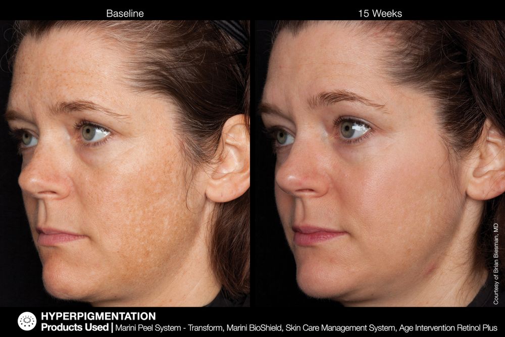 JAN MARINI AGE INTERVENTION RETINOL+ 0,5% Крем-акселератор с ретинолом 0,5% для борьбы с видимыми возрастными изменениями