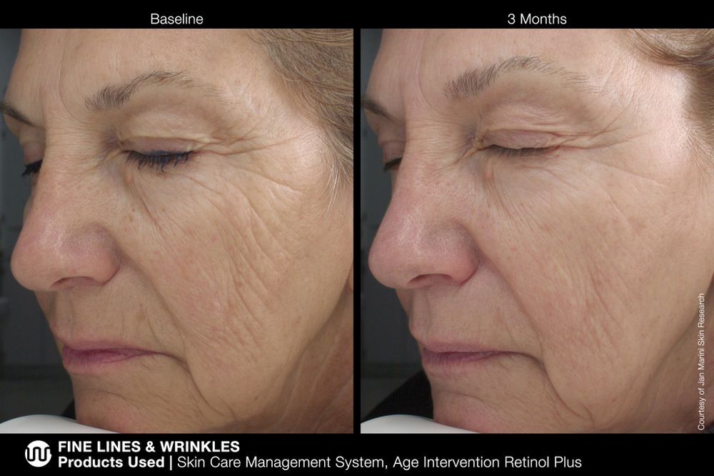 JAN MARINI AGE INTERVENTION RETINOL+ 0,5% Крем-акселератор с ретинолом 0,5% для борьбы с видимыми возрастными изменениями