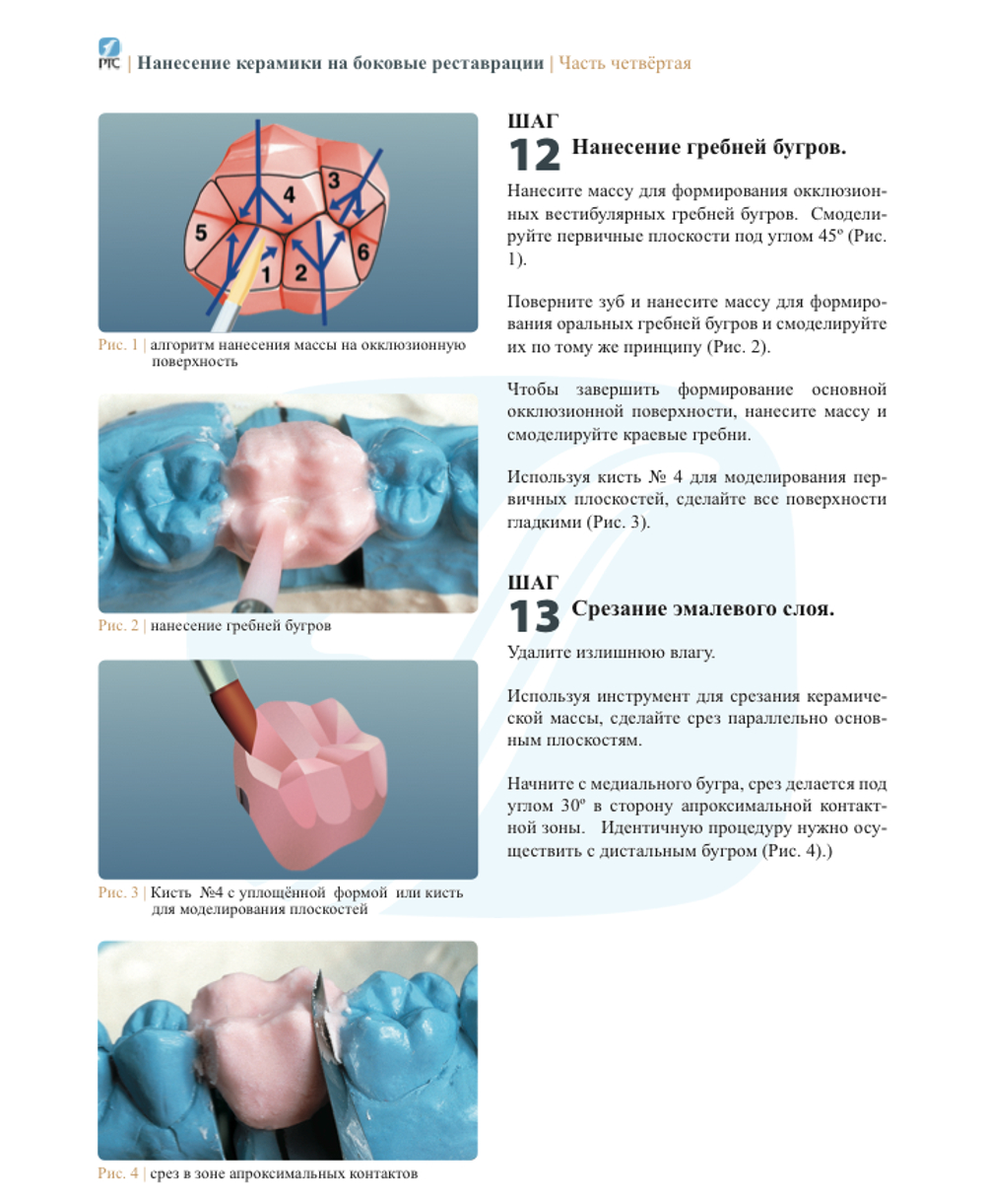 НАНЕСЕНИЕ КЕРАМИЧЕСКОЙ МАССЫ. ПЕРЕДНИЕ И БОКОВЫЕ РЕСТАВРАЦИИ.