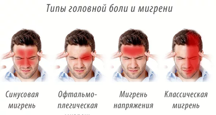 Мигрень, излечение головной боли
