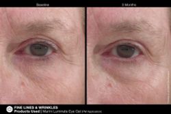 Jan Marini MARINI LUMINATE® EYE GEL Концентрированная сыворотка для кожи вокруг глаз с эффектом сияния против темных кругов и морщин.  Объем: 15 мл.