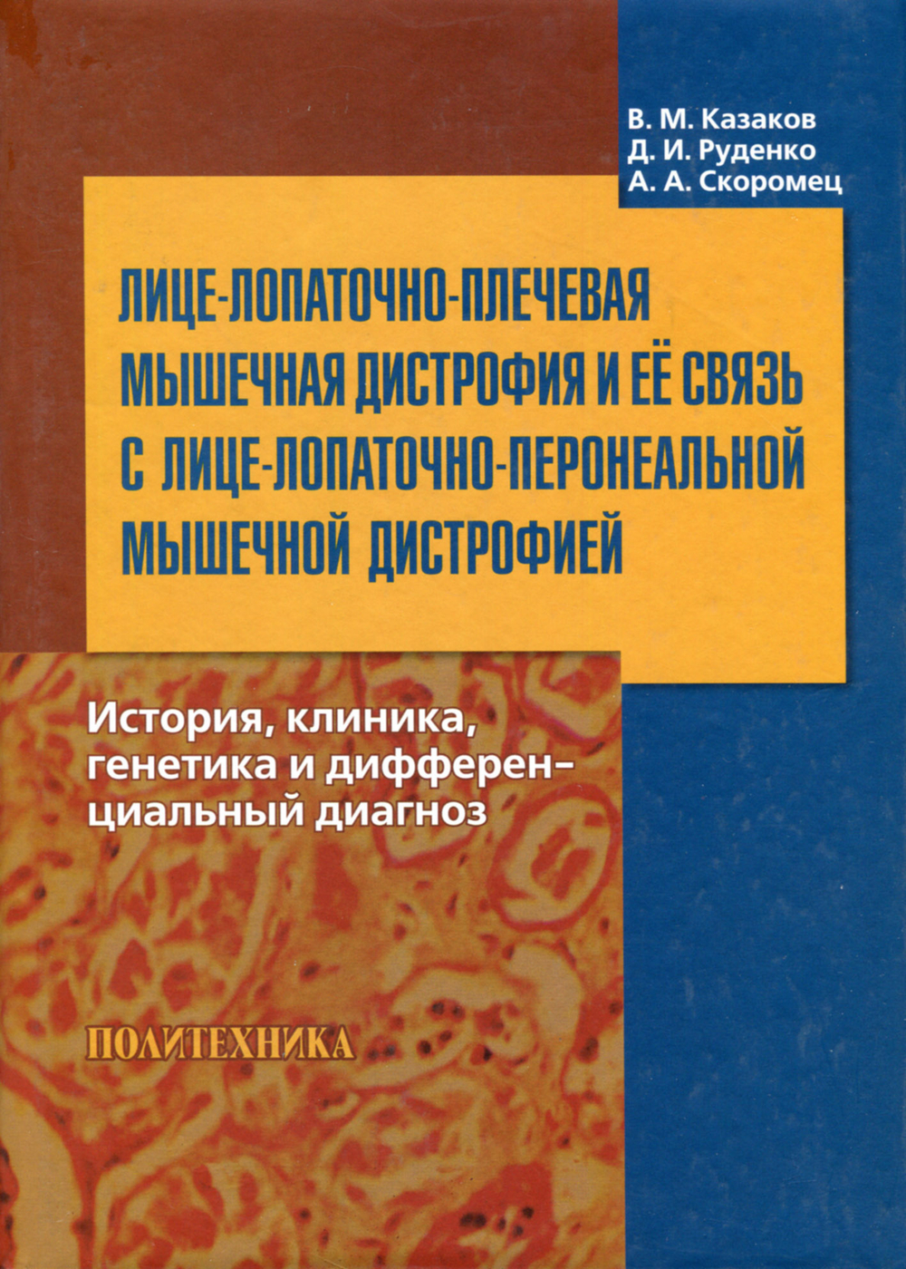 Лице-лопаточно-плечевая мышечная дистрофия и ее связь с лице-лопаточно-перонеальной мышечной дистрофией. История, клиника, генетика и дифференциальный диагноз