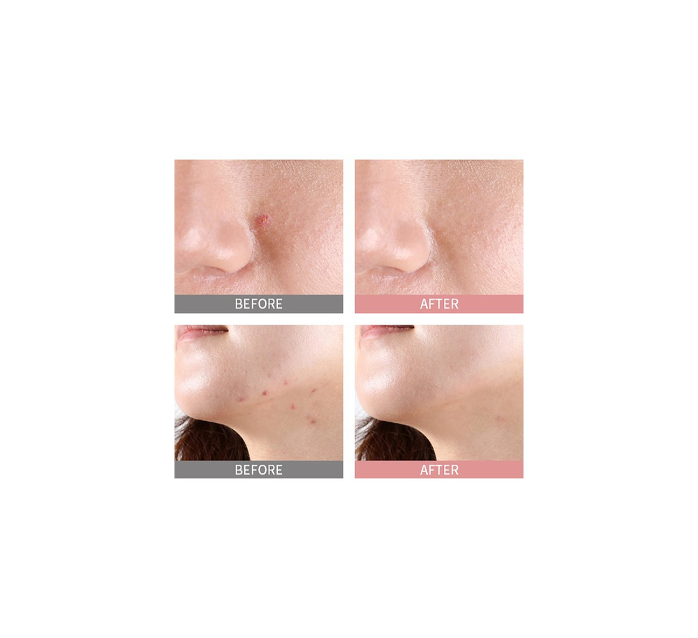 Mizon Good Bye Blemish Pink Spot - Сыворотка с порошком для местного применения против прыщей /   19  ml  / GTIN 8809663753399