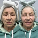 Welle Gold 17,2 Leistern