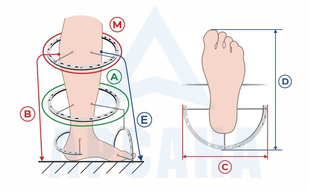 Легкий чехол с подошвой из резины на аппарат Илизарова на голени и стопе. Хлопок+ полиэстер. ОГСРЗУ-6.