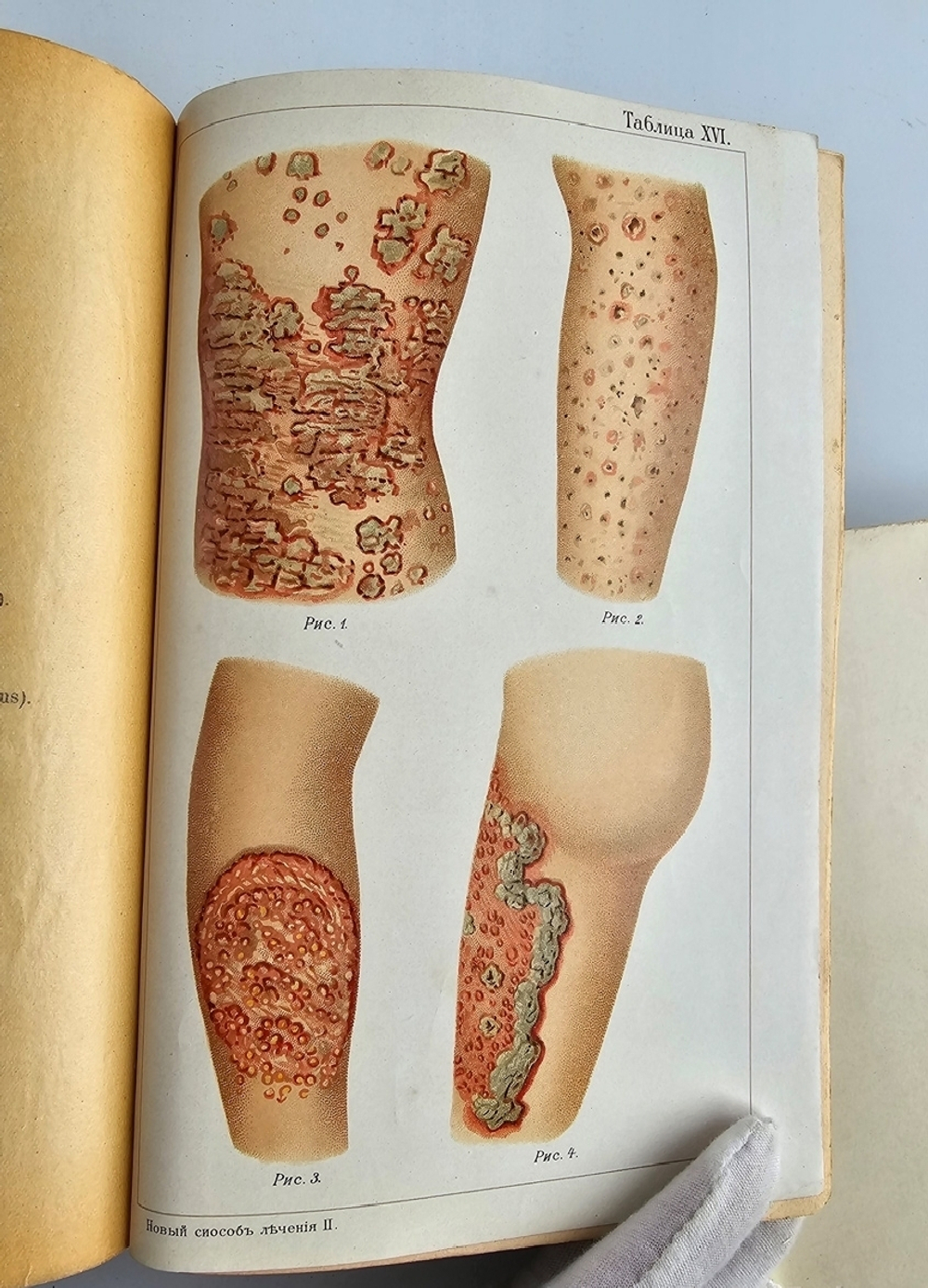 "Новый способ лечения. Лечение целебными силами природы."  М. Платен. 1906 г.