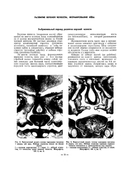 Ортопедическая стоматология. Ортодонтия, травматология, челюстное и лицевое протезирование. Атлас. Том 2 | В.Ю. Курляндский