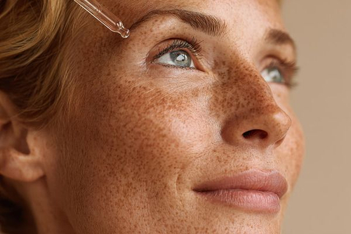 Пигментация на лице - как избавиться?